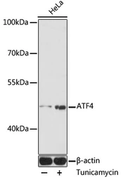 Anti-ATF4 antibody used in Western Blot (WB). GTX30070