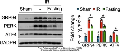Anti-ATF4 antibody used in Western Blot (WB). GTX30070