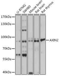 Anti-Axin 2 antibody used in Western Blot (WB). GTX30080