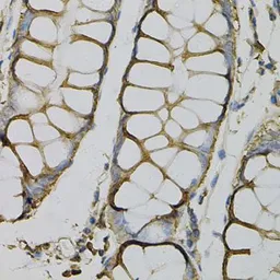 Anti-AZGP1 antibody used in IHC (Paraffin sections) (IHC-P). GTX30081