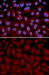 Anti-BCHE antibody used in Immunocytochemistry/ Immunofluorescence (ICC/IF). GTX30084