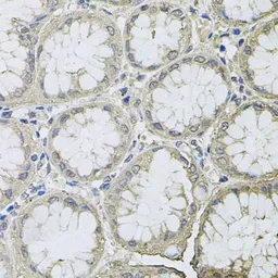 Anti-BCL2L2 antibody used in IHC (Paraffin sections) (IHC-P). GTX30087
