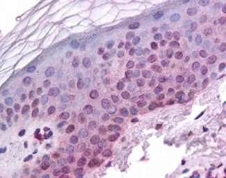 Anti-HIF1 beta antibody used in IHC (Paraffin sections) (IHC-P). GTX30109