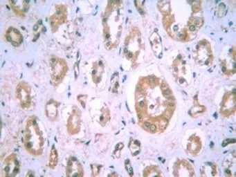 Anti-HIF1 alpha antibody [H1alpha67] used in IHC (Paraffin sections) (IHC-P). GTX30115