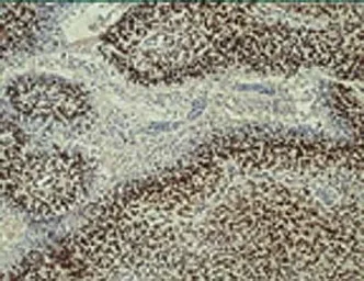 Anti-HIF1 beta antibody [H1beta234] used in IHC (Paraffin sections) (IHC-P). GTX30116