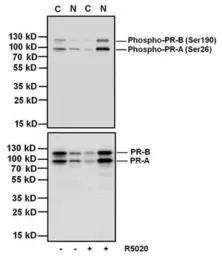 Anti-Progesterone Receptor (phospho Ser190) antibody [1154] used in Western Blot (WB). GTX30164