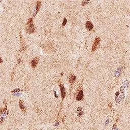 Anti-Neurofibromin antibody [McNFn27a] used in IHC (Paraffin sections) (IHC-P). GTX30208