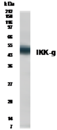 Anti-IKK gamma antibody used in Western Blot (WB). GTX30263
