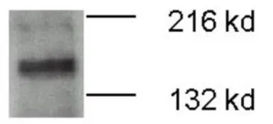 Anti-ATP7b antibody used in Western Blot (WB). GTX30639