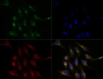 Anti-ATP7b antibody used in Immunocytochemistry/ Immunofluorescence (ICC/IF). GTX30639