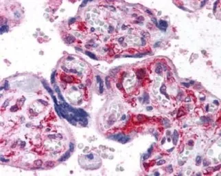Anti-HIF1 alpha antibody used in IHC (Paraffin sections) (IHC-P). GTX30647