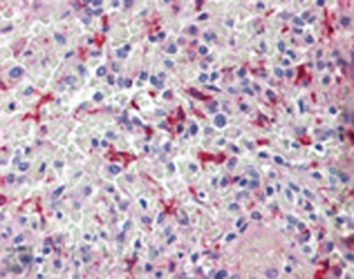 Anti-Heme Oxygenase 1 antibody used in Immunohistochemistry (IHC). GTX30748