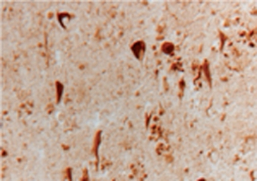 Anti-Heme Oxygenase 1 antibody used in Immunohistochemistry (IHC). GTX30748