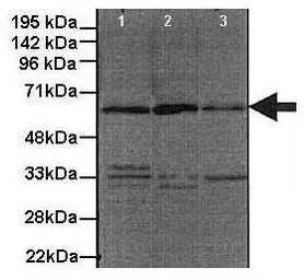 Anti-GDI1 antibody, C-term used in Western Blot (WB). GTX30781