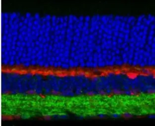 Anti-GABA A Receptor gamma 2 antibody used in Immunohistochemistry (IHC). GTX31013