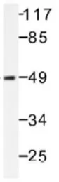 Anti-Tau (phospho Ser235) antibody used in Western Blot (WB). GTX31113
