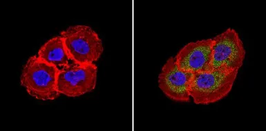 Anti-RhoA + RhoC antibody [1B3-4A10] used in Immunocytochemistry/ Immunofluorescence (ICC/IF). GTX31144