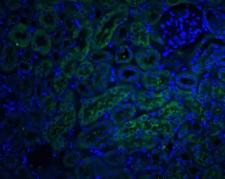 Anti-DcR2 / CD264 antibody used in IHC (Paraffin sections) (IHC-P). GTX31258