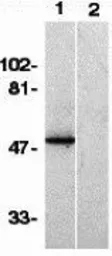 Anti-CX3CR1 antibody used in Western Blot (WB). GTX31260