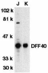 Anti-DFFB antibody used in Western Blot (WB). GTX31262