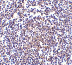 Anti-AVEN antibody used in IHC (Paraffin sections) (IHC-P). GTX31267