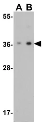 Anti-PD-L1 antibody used in Western Blot (WB). GTX31308