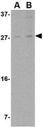 Anti-ARMET antibody used in Western Blot (WB). GTX31325