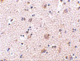 Anti-ARMET antibody used in IHC (Paraffin sections) (IHC-P). GTX31325