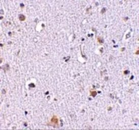 Anti-NUP160 antibody used in IHC (Paraffin sections) (IHC-P). GTX31354
