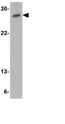 Anti-MED4 antibody used in Western Blot (WB). GTX31355