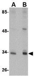 Anti-CUEDC2 antibody used in Western Blot (WB). GTX31363