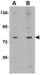 Anti-CRMP1 antibody used in Western Blot (WB). GTX31369