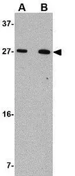 Anti-KLRA1 antibody used in Western Blot (WB). GTX31370