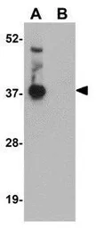 Anti-C20orf11 antibody used in Western Blot (WB). GTX31384