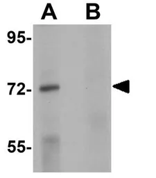 Anti-TCF3 / E2A antibody used in Western Blot (WB). GTX31402