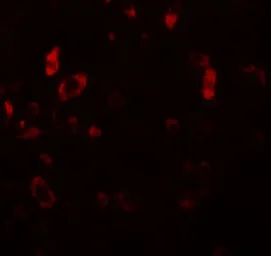 Anti-PIAS2 antibody used in IHC (Paraffin sections) (IHC-P). GTX31411
