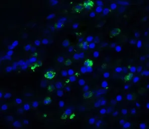 Anti-Trefoil Factor 3 antibody used in IHC (Paraffin sections) (IHC-P). GTX31422