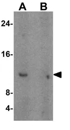 Anti-Trefoil Factor 3 antibody used in Western Blot (WB). GTX31422