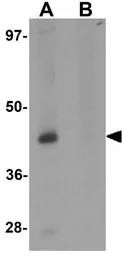 Anti-Protor 1 antibody used in Western Blot (WB). GTX31436