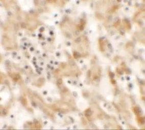 Anti-NKX2.8 antibody used in IHC (Paraffin sections) (IHC-P). GTX31471
