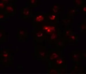 Anti-TSHZ2 antibody used in Immunocytochemistry/ Immunofluorescence (ICC/IF). GTX31473