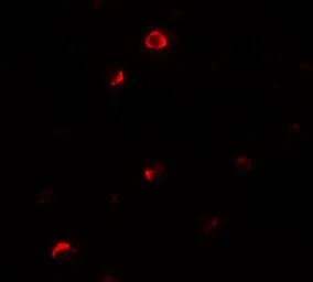 Anti-Pellino1 antibody used in Immunocytochemistry/ Immunofluorescence (ICC/IF). GTX31504
