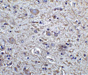 Anti-FOXP3 antibody used in IHC (Paraffin sections) (IHC-P). GTX31517