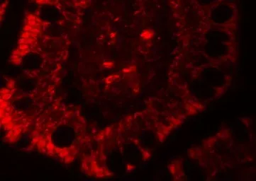 Anti-RC3H1 antibody used in IHC (Paraffin sections) (IHC-P). GTX31528
