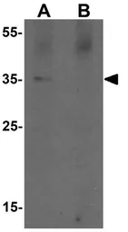 Anti-PRKCDBP antibody used in Western Blot (WB). GTX31530