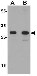 Anti-TLX3 antibody used in Western Blot (WB). GTX31542