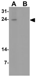 Anti-IL1F5 antibody used in Western Blot (WB). GTX31556