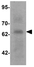 Anti-GRK6 antibody used in Western Blot (WB). GTX31564