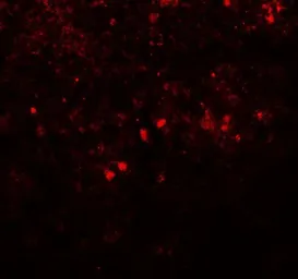 Anti-SREBP1 antibody used in IHC (Paraffin sections) (IHC-P). GTX31579
