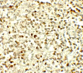 Anti-NOX4 antibody used in IHC (Paraffin sections) (IHC-P). GTX31588